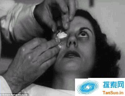 惊悚！1948年隐形眼镜制作过程曝光 用活人眼球制作模型